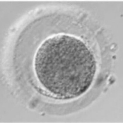 Micrografía de un ovocito atrésico, con el citoplasma retraído y granulado en oscuro
