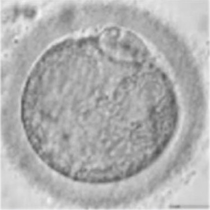 Micrografía de un ovocito con el citoplasma de textura granulosa