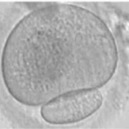 Micrografía de un ovocito con un corpúsculo polar de tamaño desproporcionado