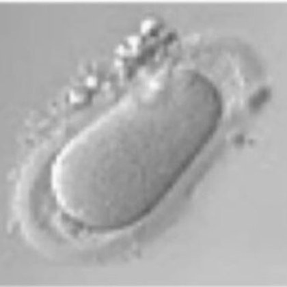 Micrografía de un ovocito de forma ovalada en lugar de esférica