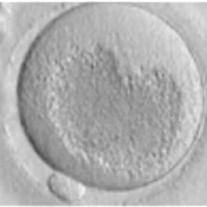Micrografía de un ovocito con el retículo endoplásmico visible como una zona clara
