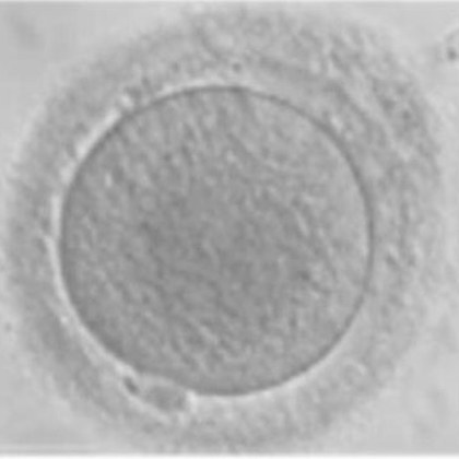 Micrografía de un ovocito con la zona pelúcida engrosada