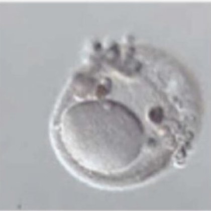 Micrografía de un ovocito con la zona pelúcida tabicada