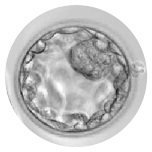 Micrografía de un blastocisto viable