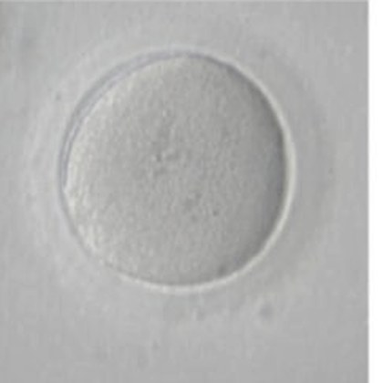 Micrografía de un ovocito en metafase I, sin corpúsculo polar visible