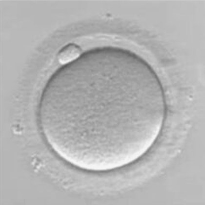 Micrografía de un ovocito en metafase II, translúcido y con un solo corpúsculo polar en el espacio perivitelino