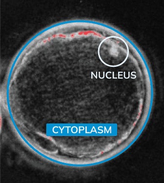 Micrografía de un óvulo humano, con el núcleo señalado y el citoplasma delimitado, anotada en el laboratorio de Ingenes