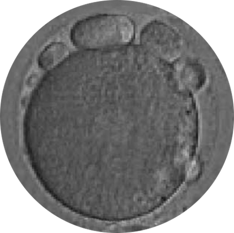 Micrografía de un óvulo de baja calidad: citoplasma oscuro y granular, con vacuolas visibles bajo la zona pelúcida