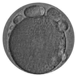 Micrografía de un óvulo de baja calidad, oscuro y granular